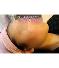 전후사진