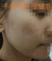 전후사진