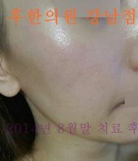 전후사진