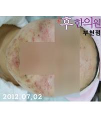 전후사진