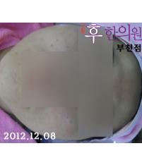전후사진