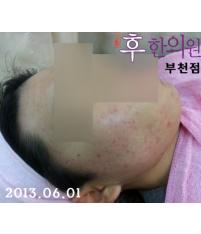 전후사진