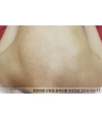 전후사진