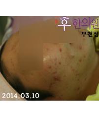 전후사진