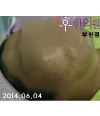 전후사진