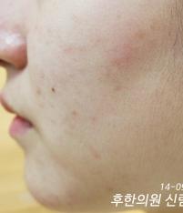 전후사진