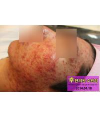 전후사진