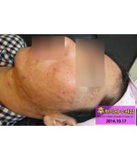전후사진