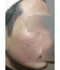 전후사진