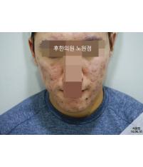 전후사진