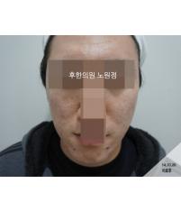 전후사진