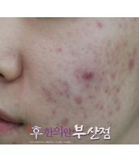 전후사진