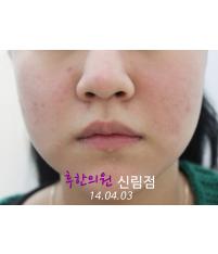전후사진