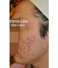 전후사진