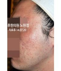 전후사진