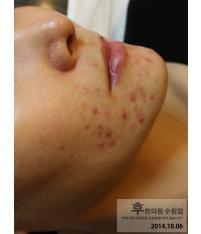 전후사진