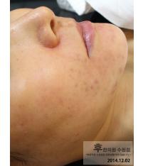 전후사진