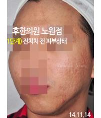 전후사진