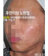 전후사진