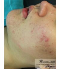 전후사진