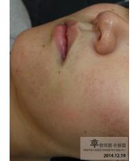 전후사진