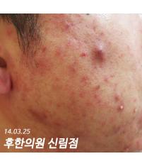전후사진