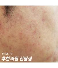 전후사진