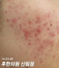 전후사진