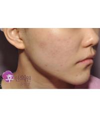 전후사진