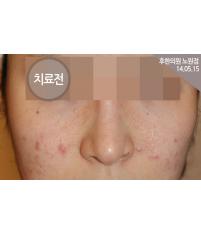 전후사진