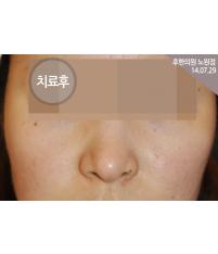 전후사진
