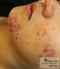 전후사진