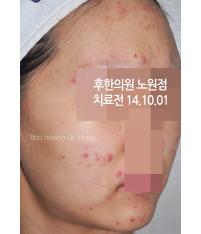 전후사진