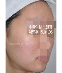 전후사진