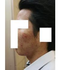 전후사진