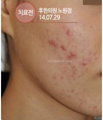 전후사진