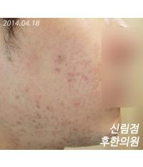 전후사진