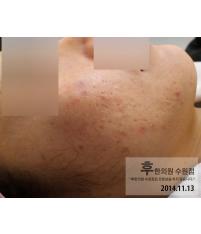 전후사진