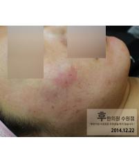 전후사진