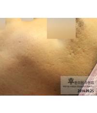 전후사진