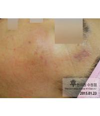 전후사진