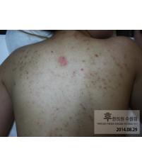 전후사진
