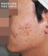 전후사진
