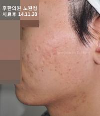 전후사진