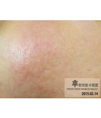 전후사진