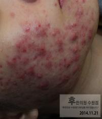 전후사진
