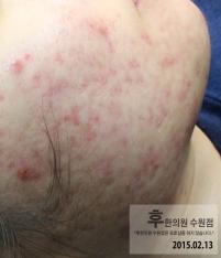 전후사진
