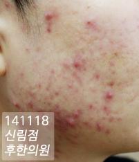 전후사진