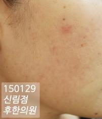 전후사진