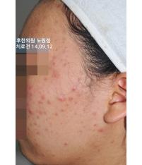 전후사진